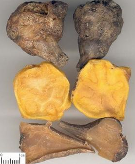 治療萎縮性鼻炎的中藥偏方