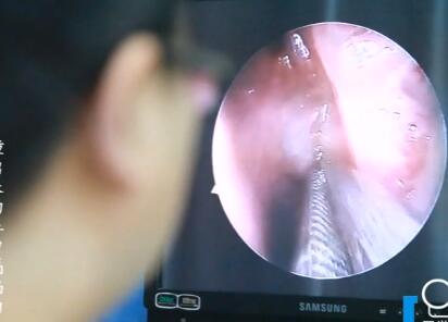 仁品醫生檢查鼻中隔偏曲患者