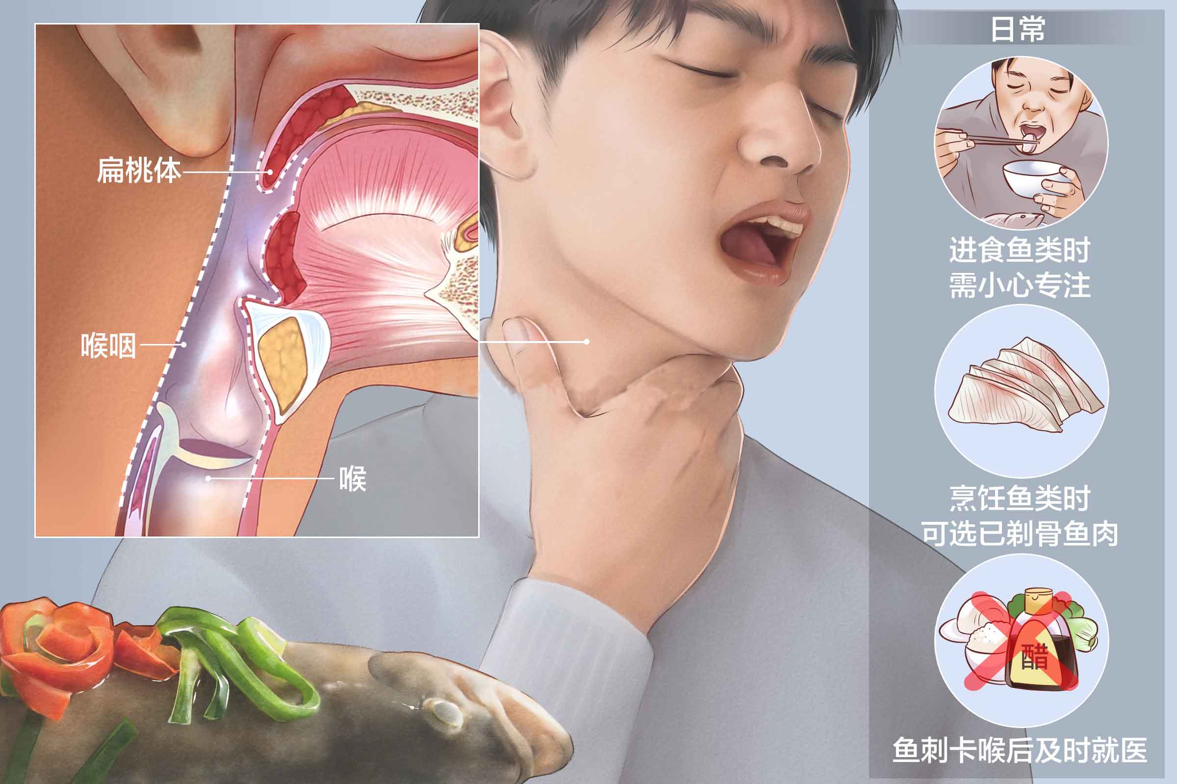 成都治療卡魚刺醫院